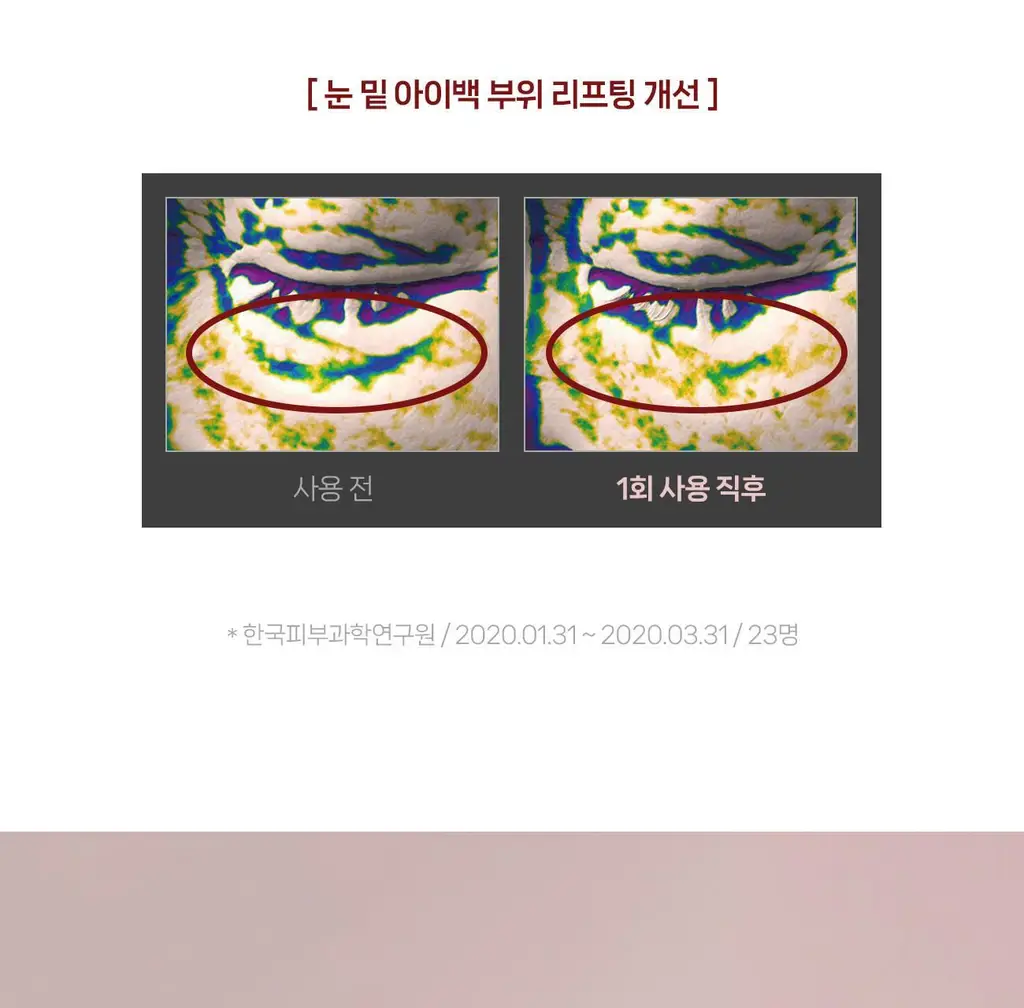 [올리브영 1위] 더마픽스 퍼펙트 퍼포먼스 콜라겐 1+1기획 (3종 1택) 상세페이지 42
